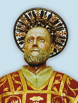 sanfilippo2
